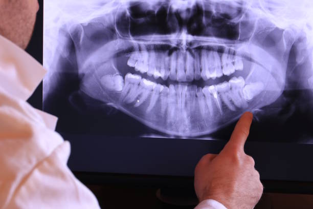 Best Emergency Treatment for Oral Infections in Bellmawr, NJ